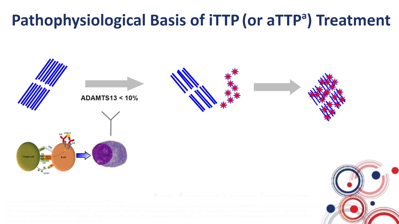 How to Treat iTTP in 2020