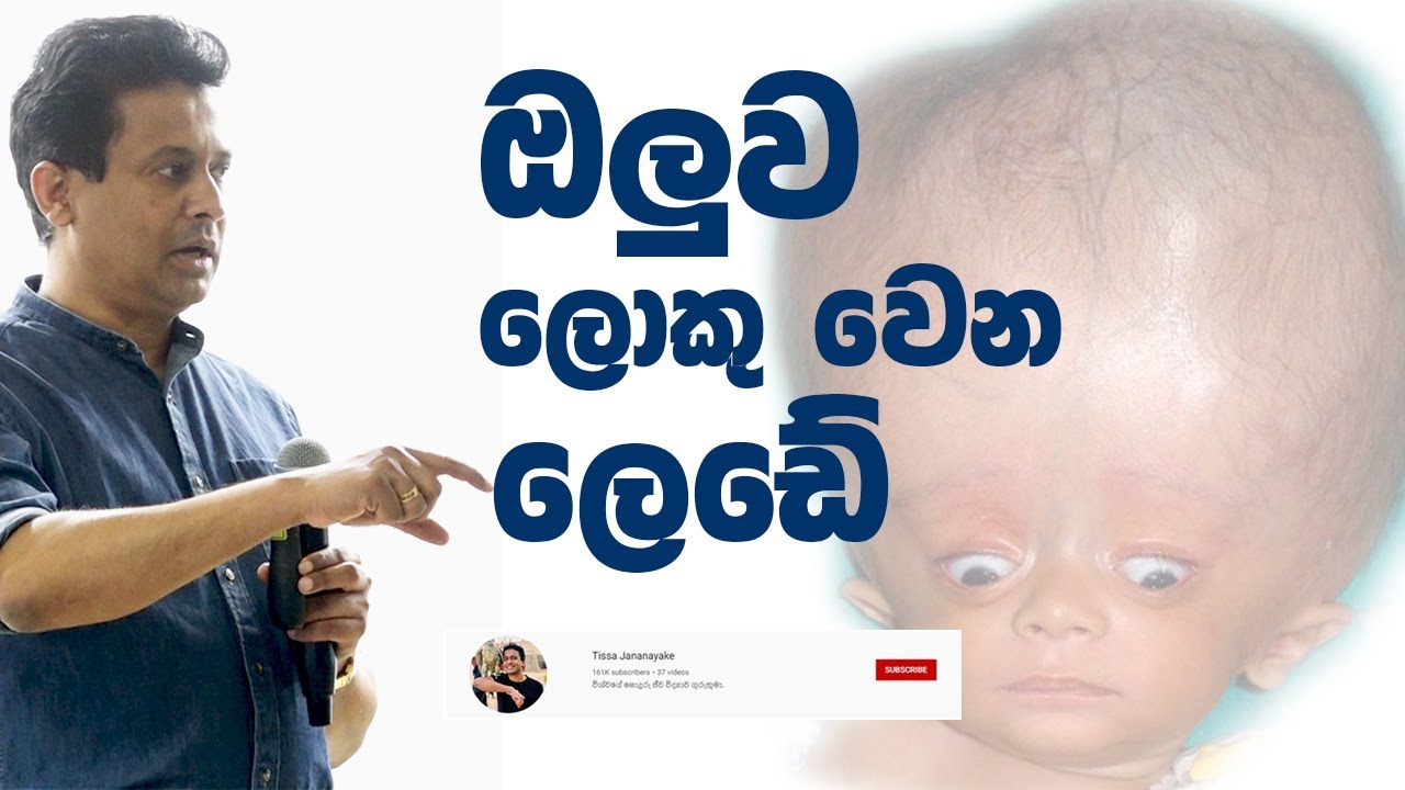 Tissa Jananayake - Episode 219 | ඔලුව ලොකු වෙන ලෙඩේ - Hydrocephalus