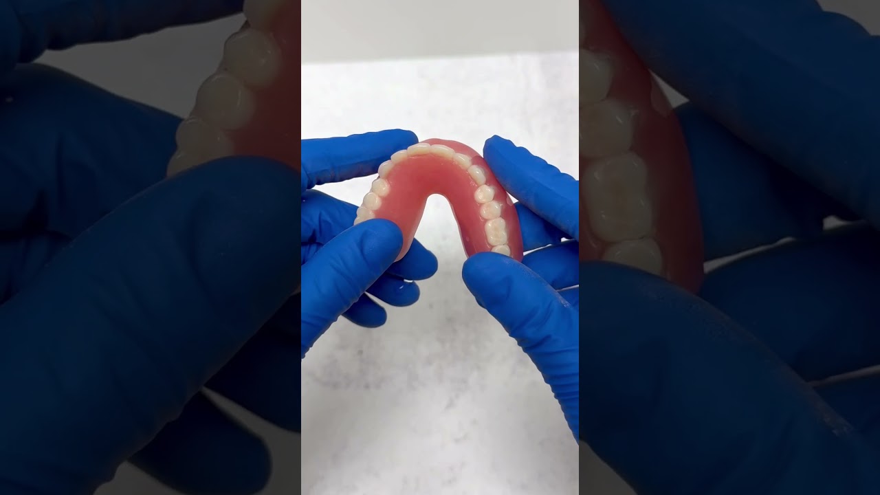 Highlight on This Traditional Top Denture! 😁 #bossiercitydentist #teethinaday