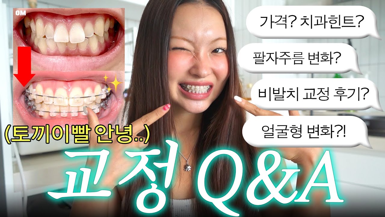 교정 6개월차의 리얼 후기..😬 가격, 얼굴형 변화, 교정 꿀팁 총정리 큐앤에이🦷