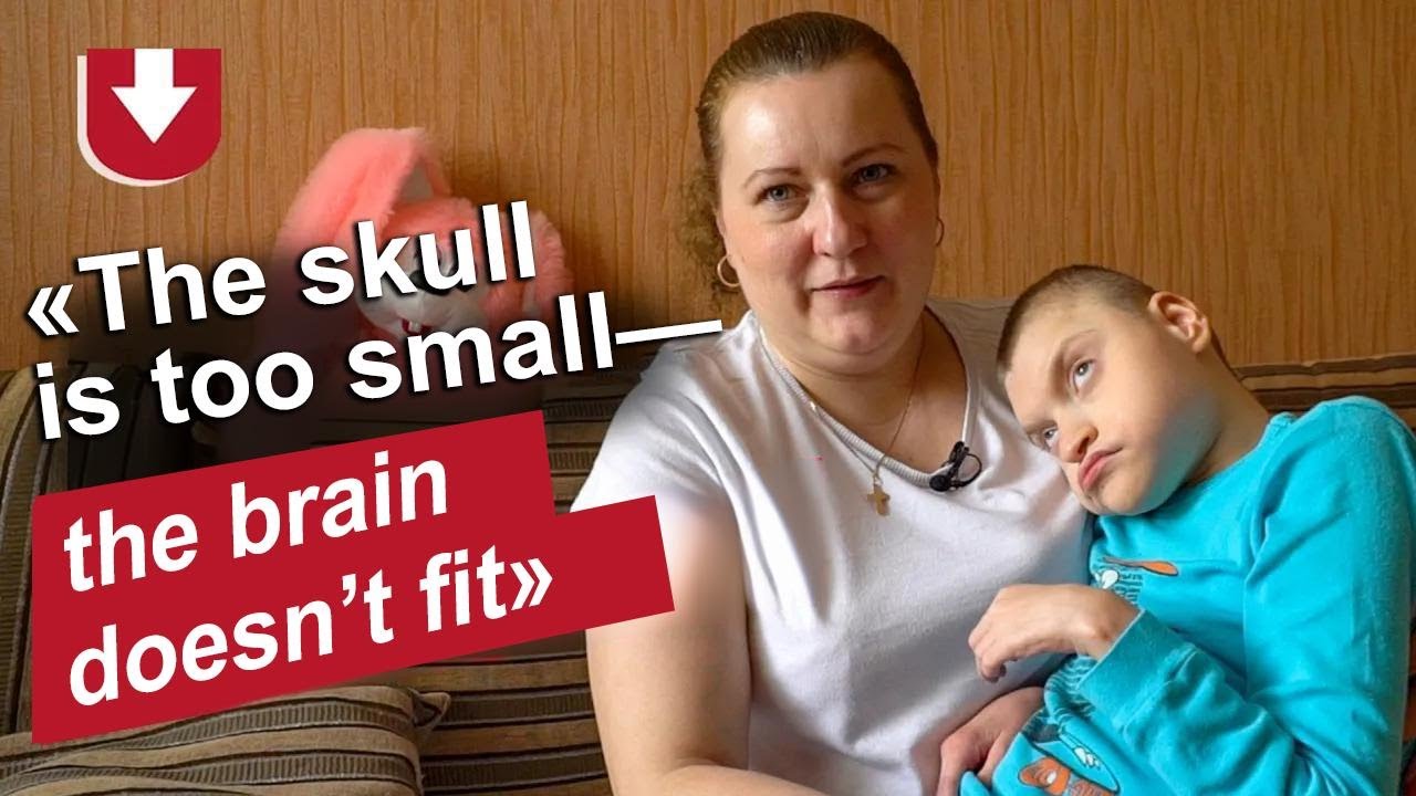 My Son Has Microcephaly: Anna's Story | Being a Mom