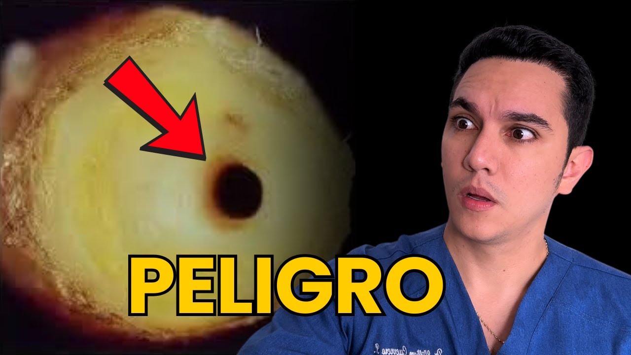 &iexcl;Alerta! Se&ntilde;ales de que tu coraz&oacute;n est&aacute; en peligro | Dr. William Guerrero