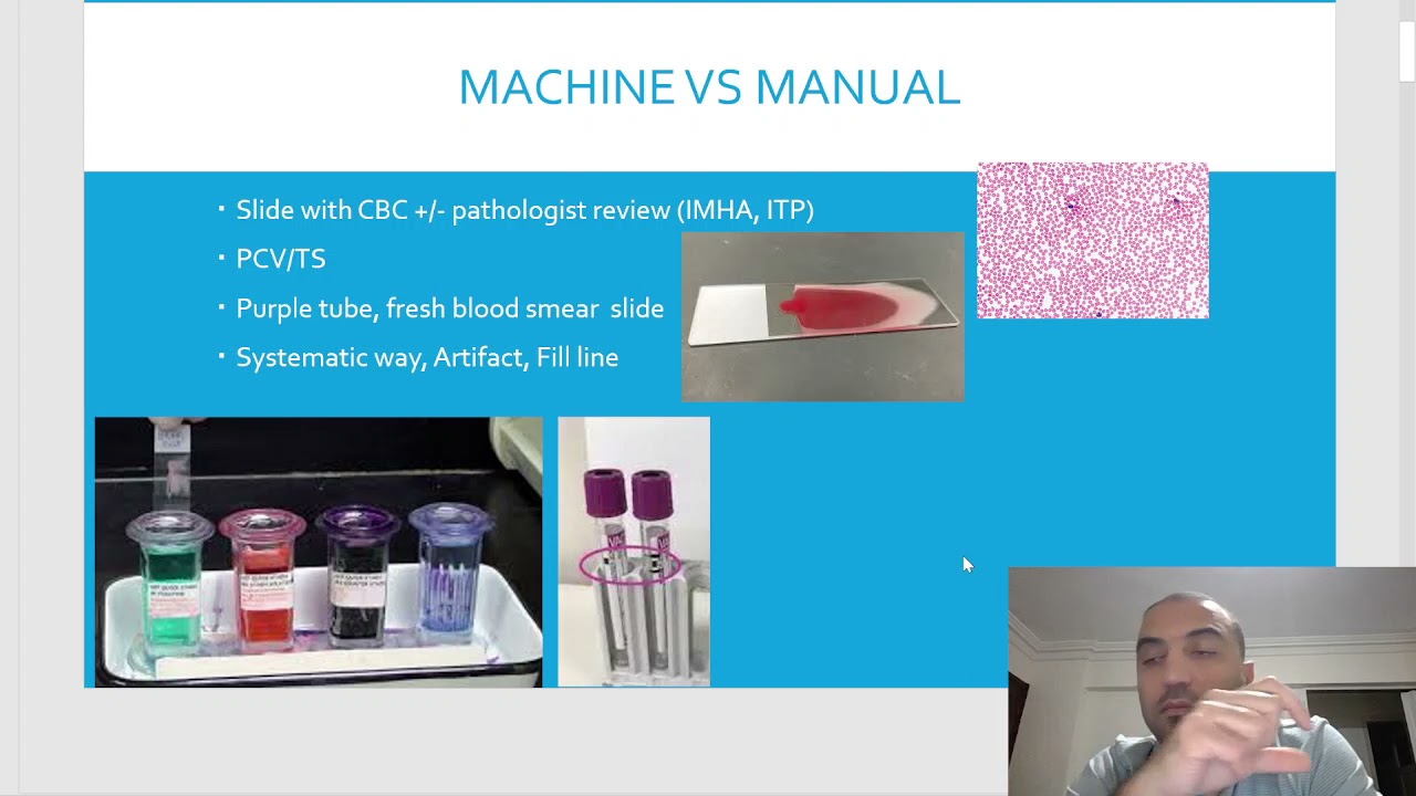 Lab diagnostics 5/15:Canine & feline CBC 1st/3 video  تحليل صورة الدم حيوانات أليفة جزء1