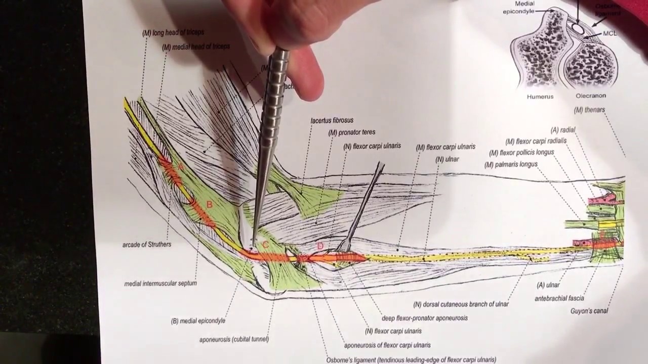 Ulnar Nerve Compression Sites / Cubital Tunnel Syndrome