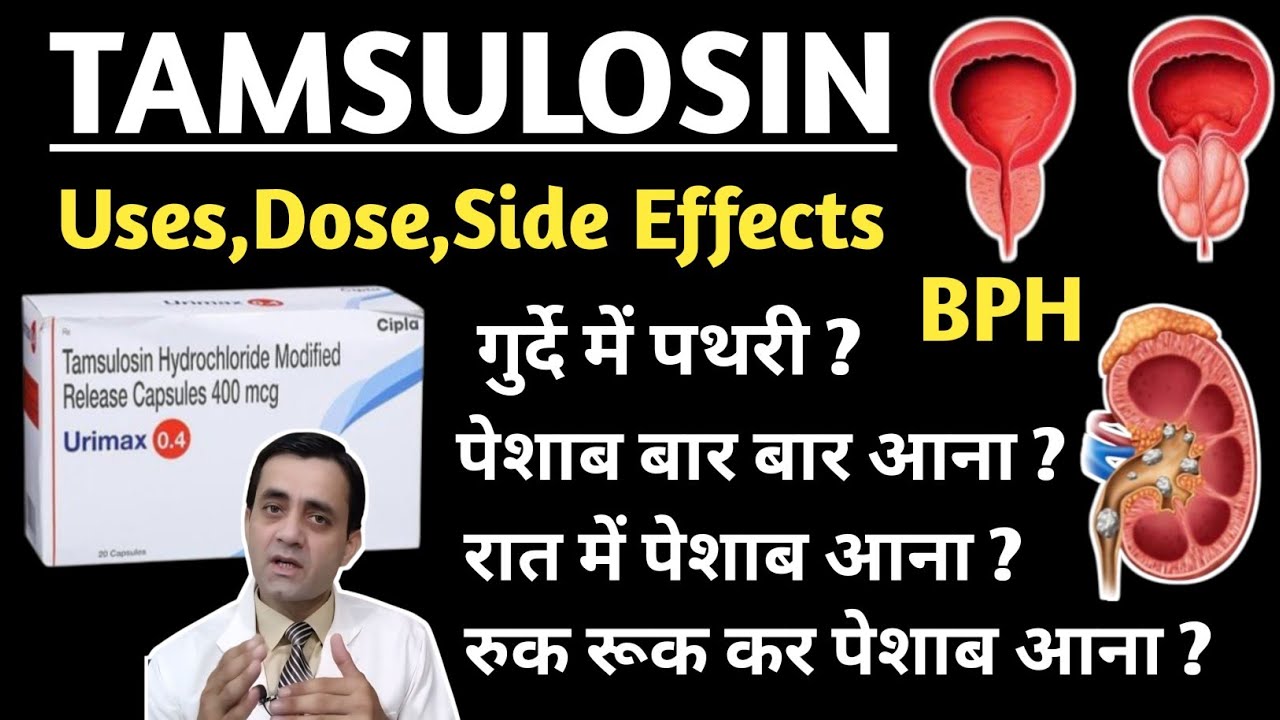 Tamsulosin hcl 0.4 mg capsule uses / Tamsulosin hydrochloride tablet 0.4 mg uses in hindi