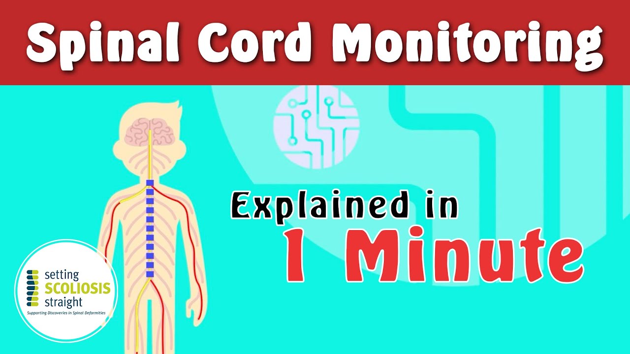 Spinal Cord Monitoring   |   Explained Under 1 Minute