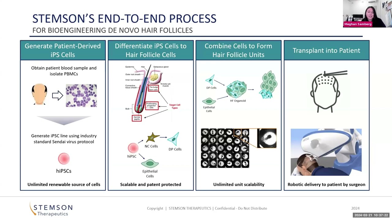 #Bioprinting #hair follicles for #skin with Dr. Meghan Samberg from Stemson Therapeutics