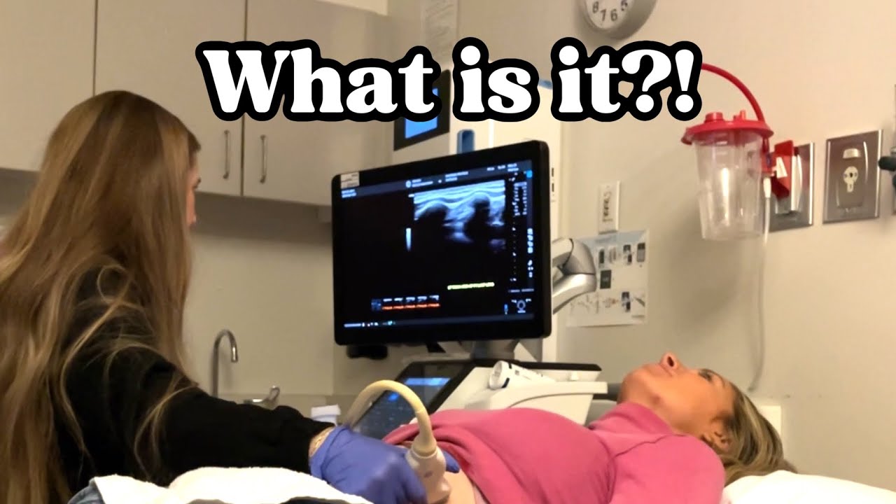 Ей пришлось сделать УЗИ!