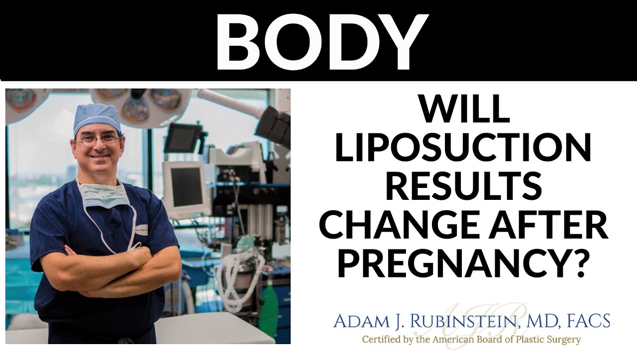 Plastic Surgery Truths - Will Liposuction results change after pregnancy?