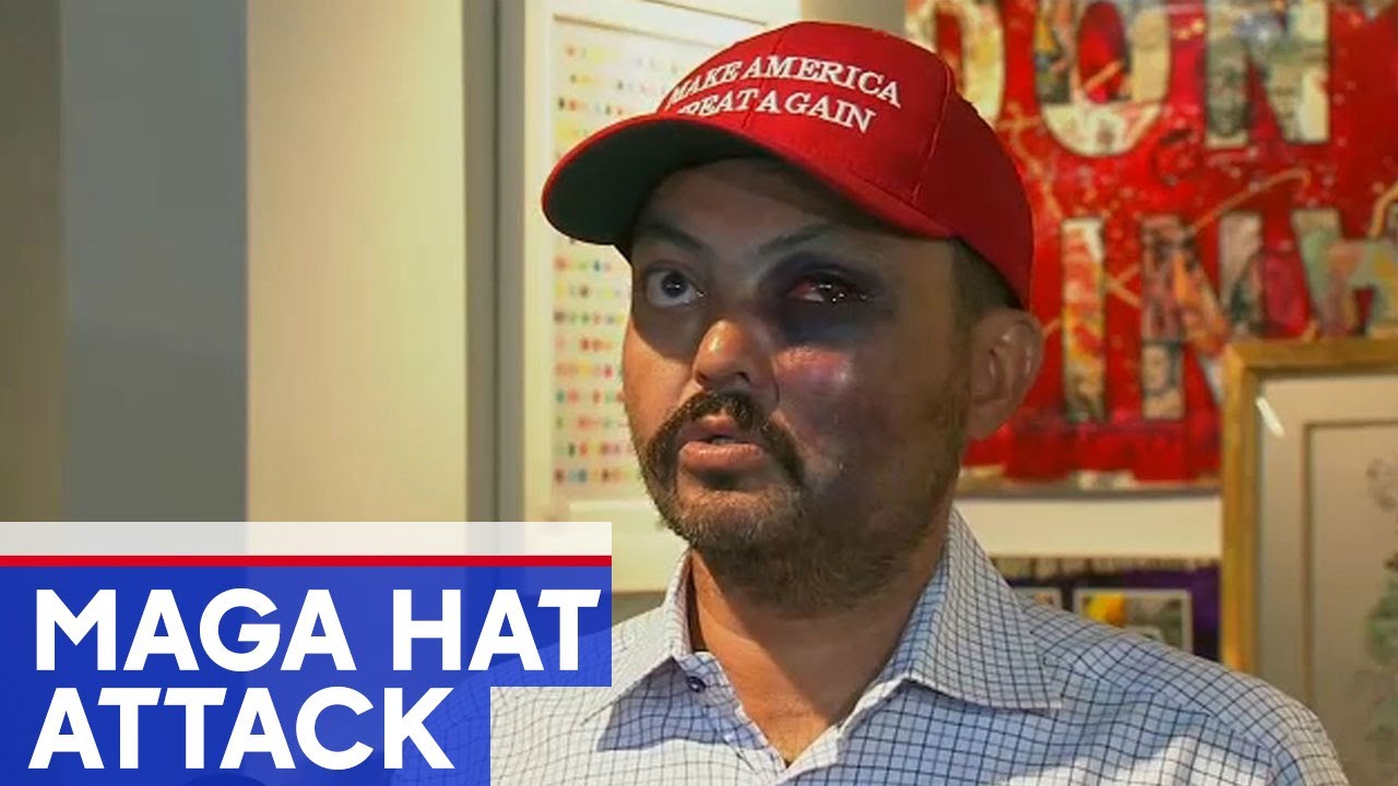 NYC gallery owner says he was attacked for wearing MAGA hat
