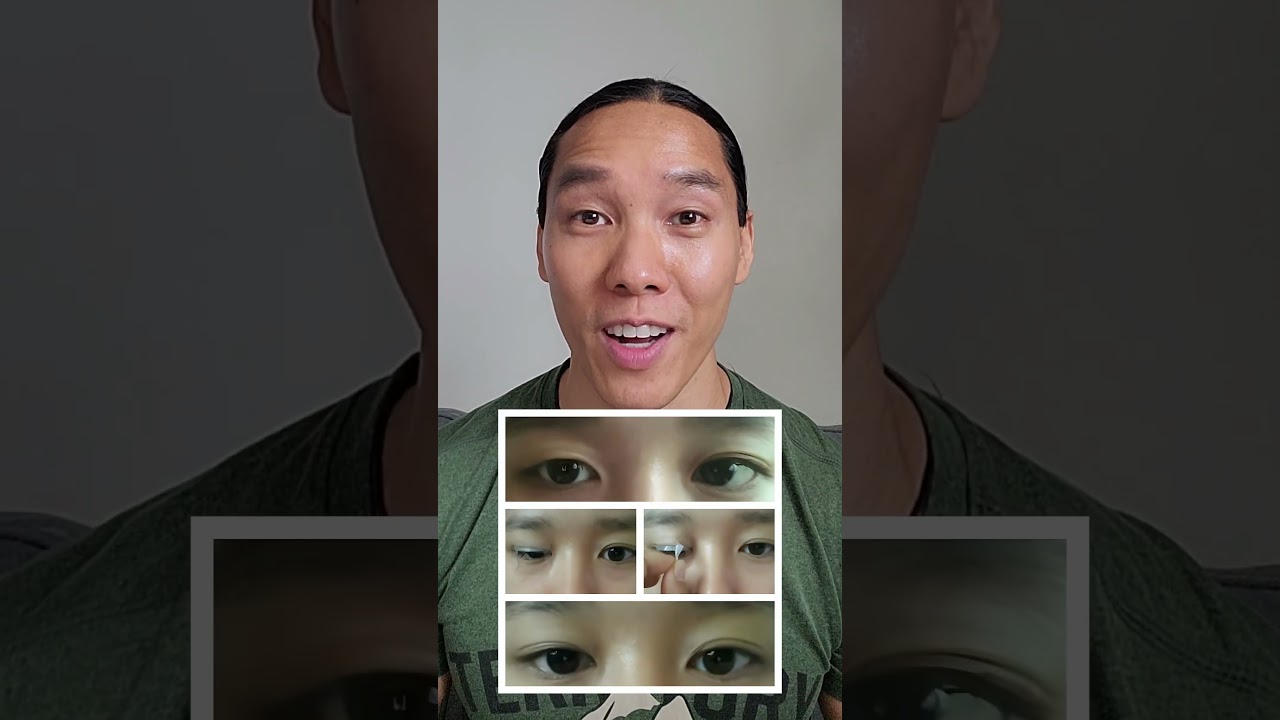 Create double eyelids while you sleep? My invention fixes your eyelids 👁 ✨