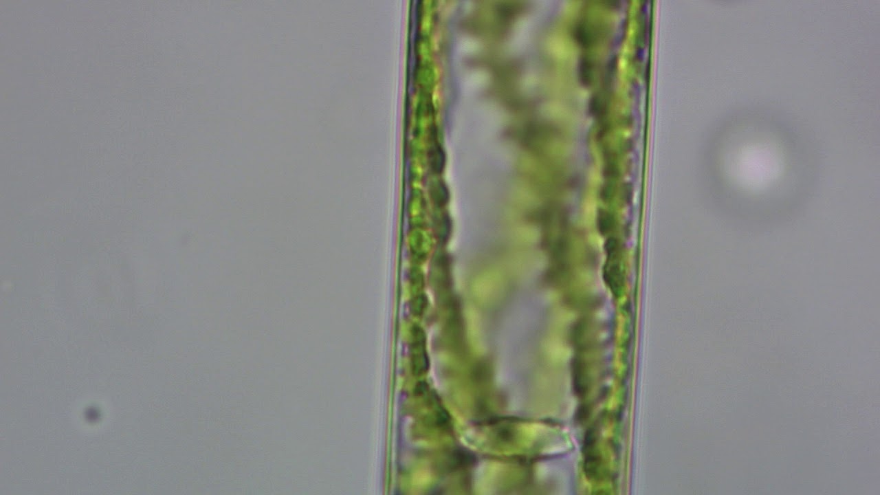 Spirogyra 400x
