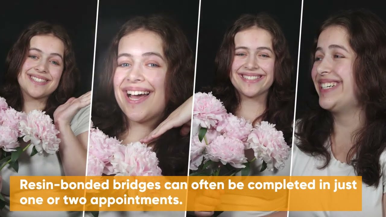 Jadyn's Journey from Missing two Front teeth to Fuller Smile | Resin Bonded Bridge -No Teeth Shaving