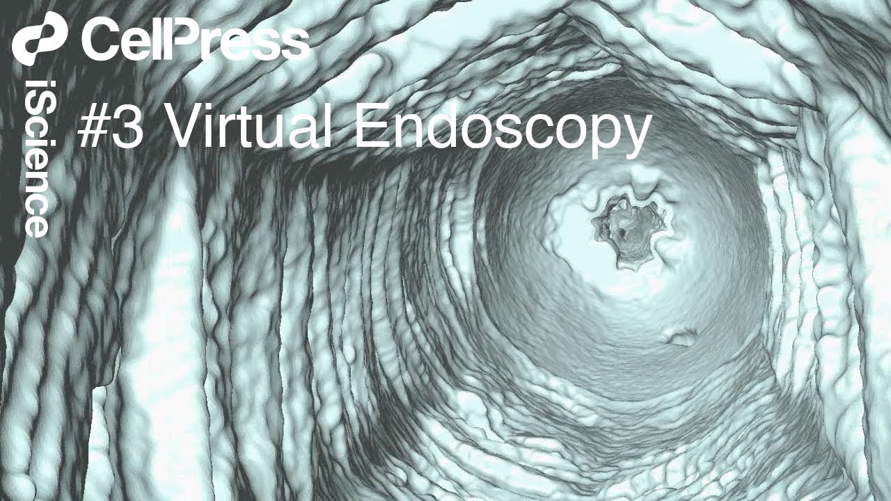 Micro CT Imaging of the Tobacco Hornworm Caterpillar : Virtual Endoscopy of the Alimentary Tract
