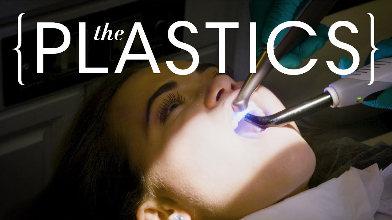 What Do $60,000 Veneers Look Like? | The Plastics | Harper's BAZAAR
