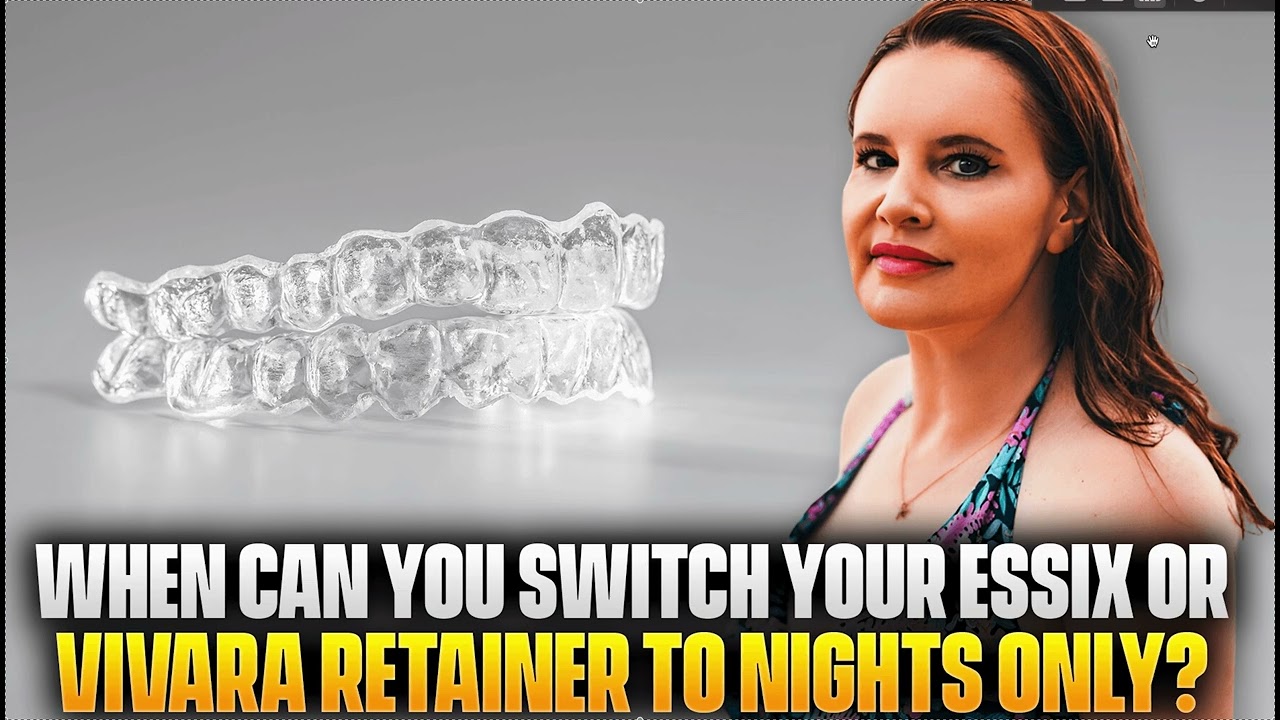 Retainer Wear Protocol When can you Phase Down your Essix or Vivara Retainer to NIghts Only?