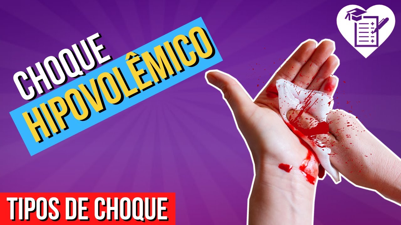 CHOQUE HIPOVOLÊMICO - Causas, Sintomas e Tratamento