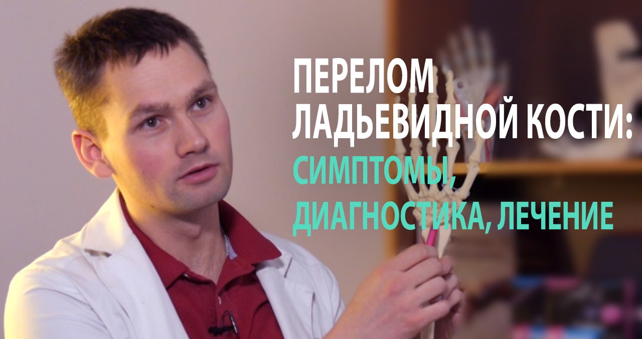 Перелом ладьевидной кости: симптомы, диагностика, лечение