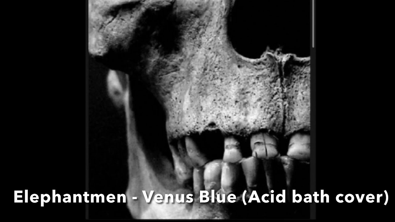 Elephantmen - Venus Blue (Acid Bath Cover)