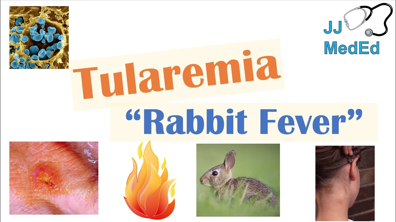 Tularemia (Rabbit Fever) | Causes, Pathogenesis, Forms, Symptoms, Diagnosis, Treatment