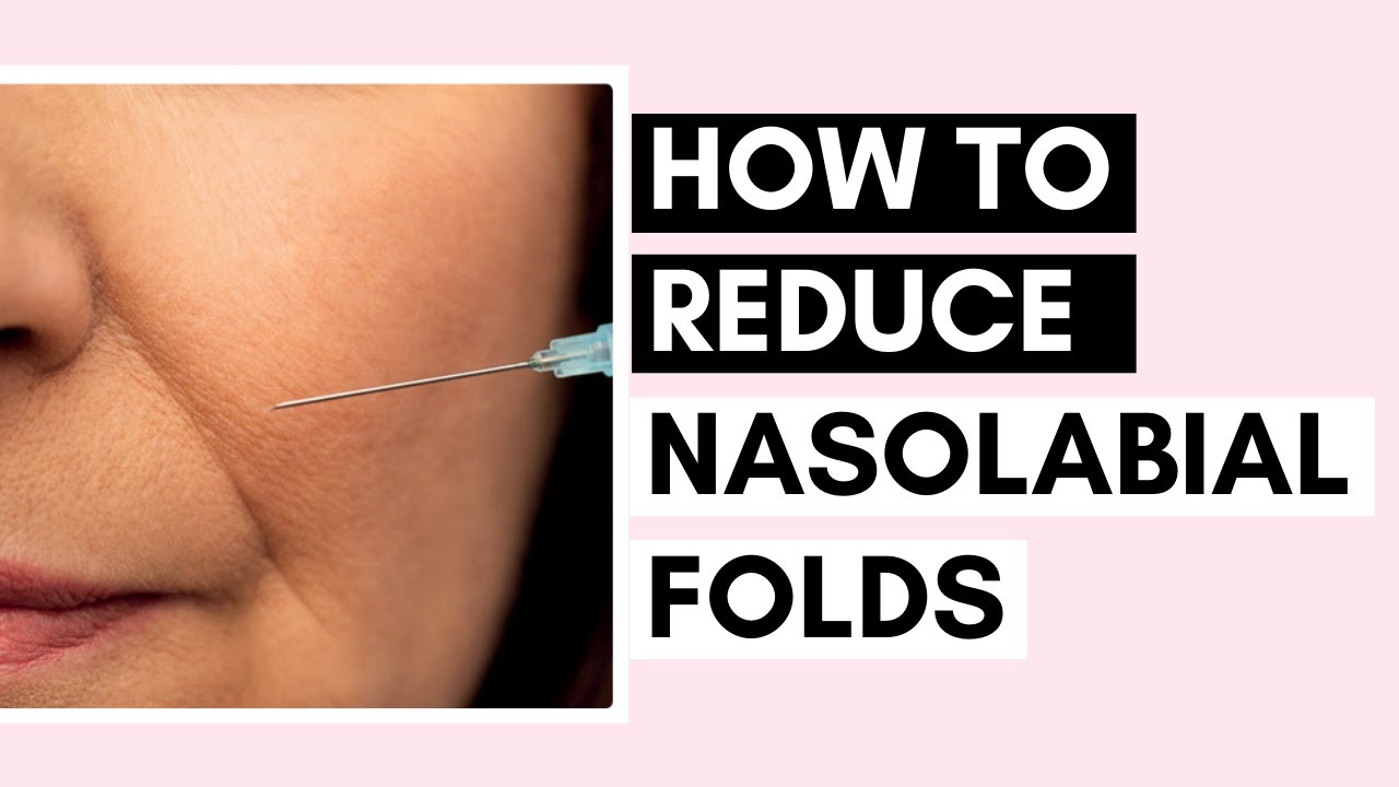8 Ways To Reduce Nasolabial Folds | Fillers, Threads, Face Massage, And More Tips