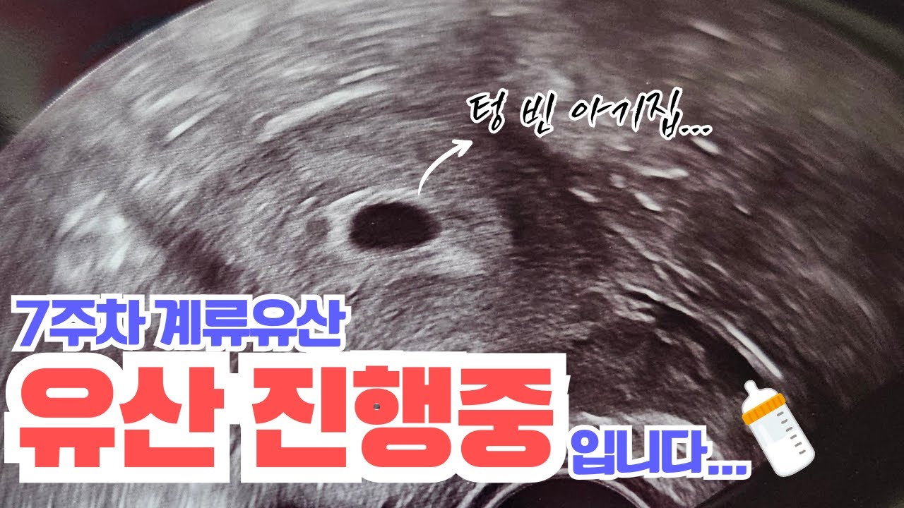 7주차 고사난자 계류유산 임신종결 이야기 feat.내 인생 최고의 한 달🩷