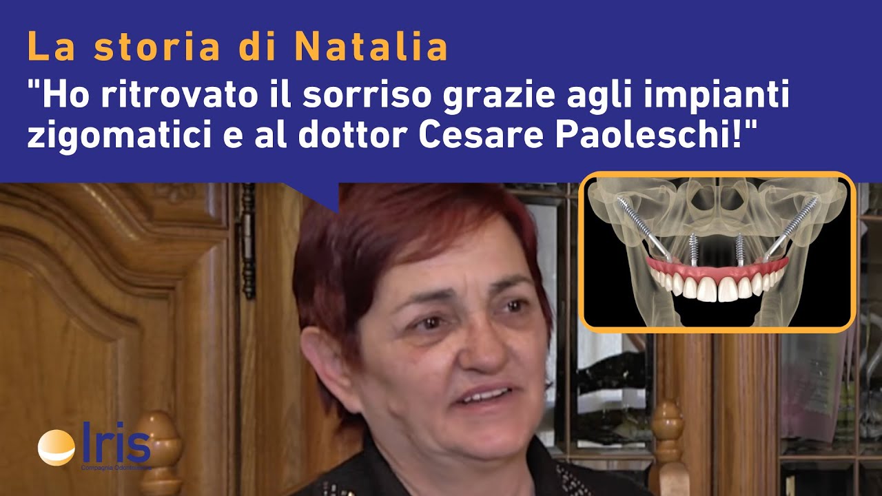 Impianti zigomatici: la storia di Natalia