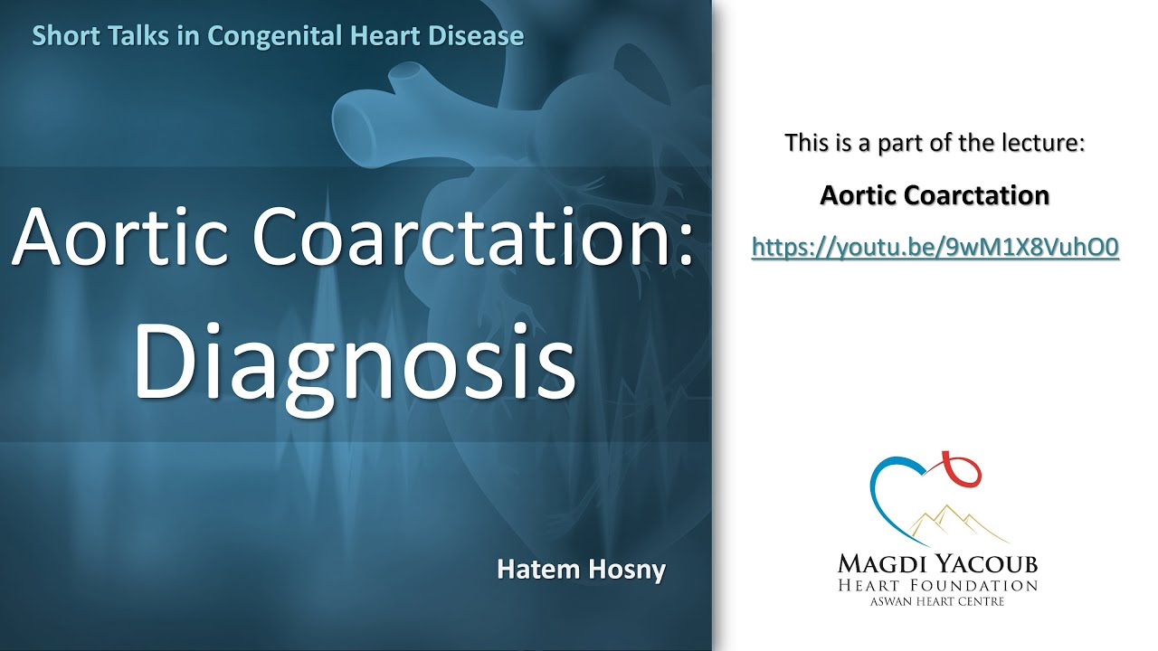 Aortic Coarctation: Diagnosis - Hatem Hosny