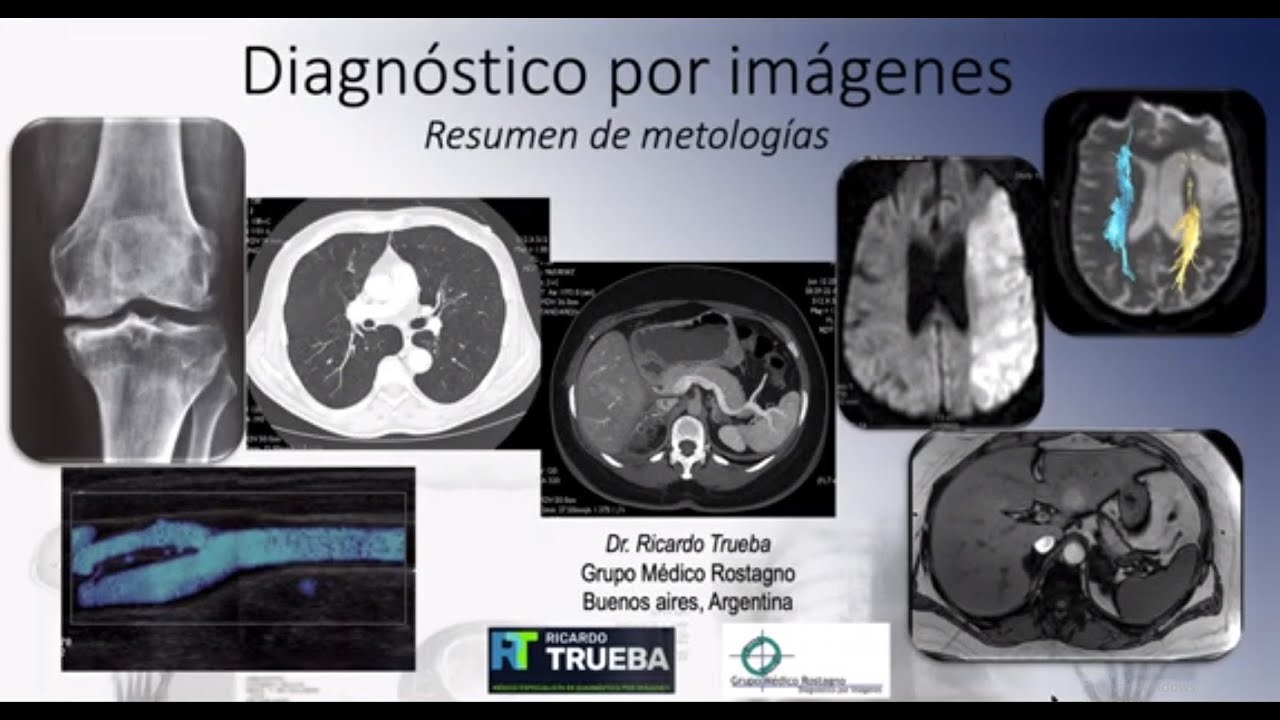METODOS DE DIAGNOSTICO POR IMAGENES