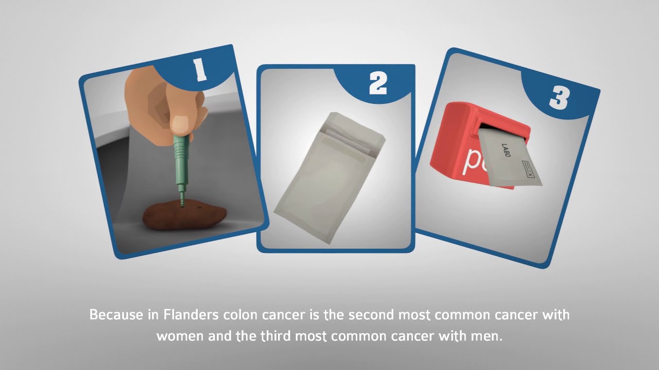 Animation film population screening for colon cancer