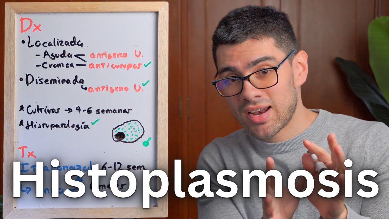 Histoplasmosis Explicada Claramente