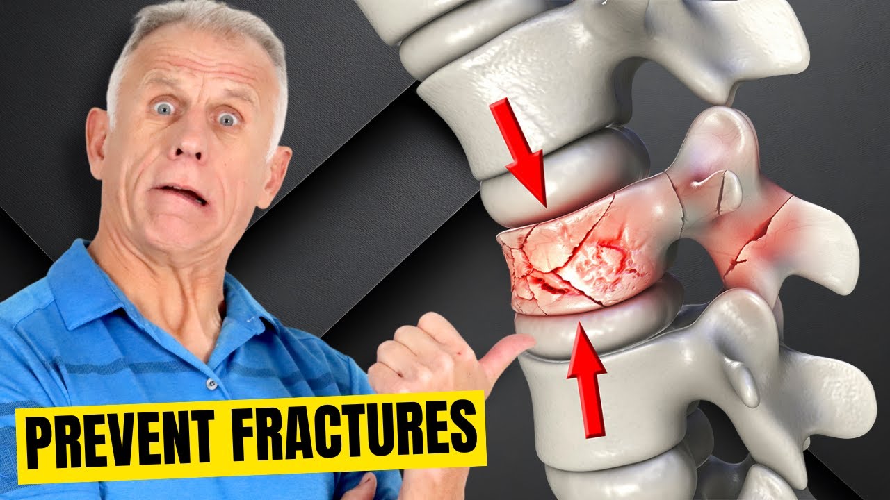 3 Things You MUST AVOID if You Have Osteoporosis (And What to Do)
