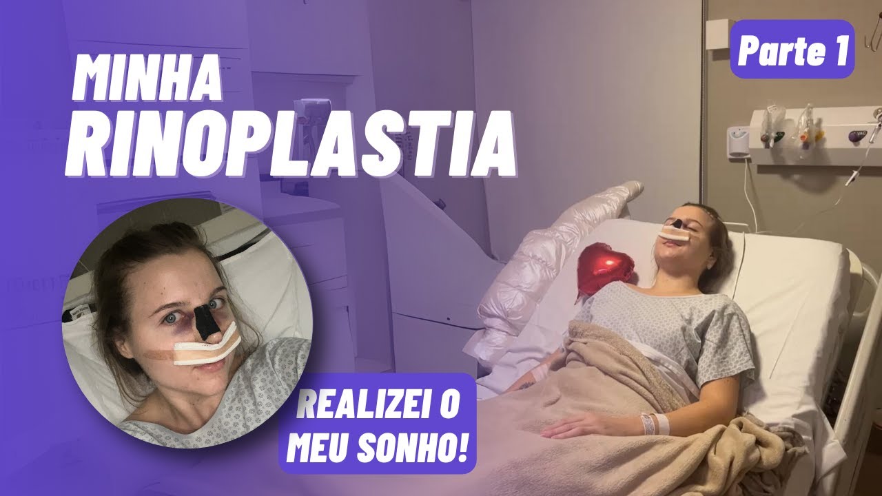 Fiz rinoplastia e desvio de septo em Curitiba - Quanto custa? Consultas, exames e dia da cirurgia