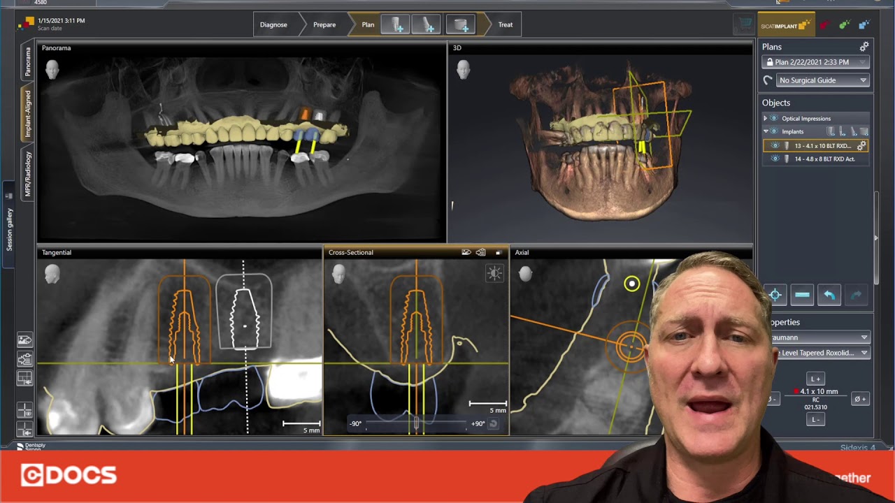 Tip of the Day: Safety Margins on Implants