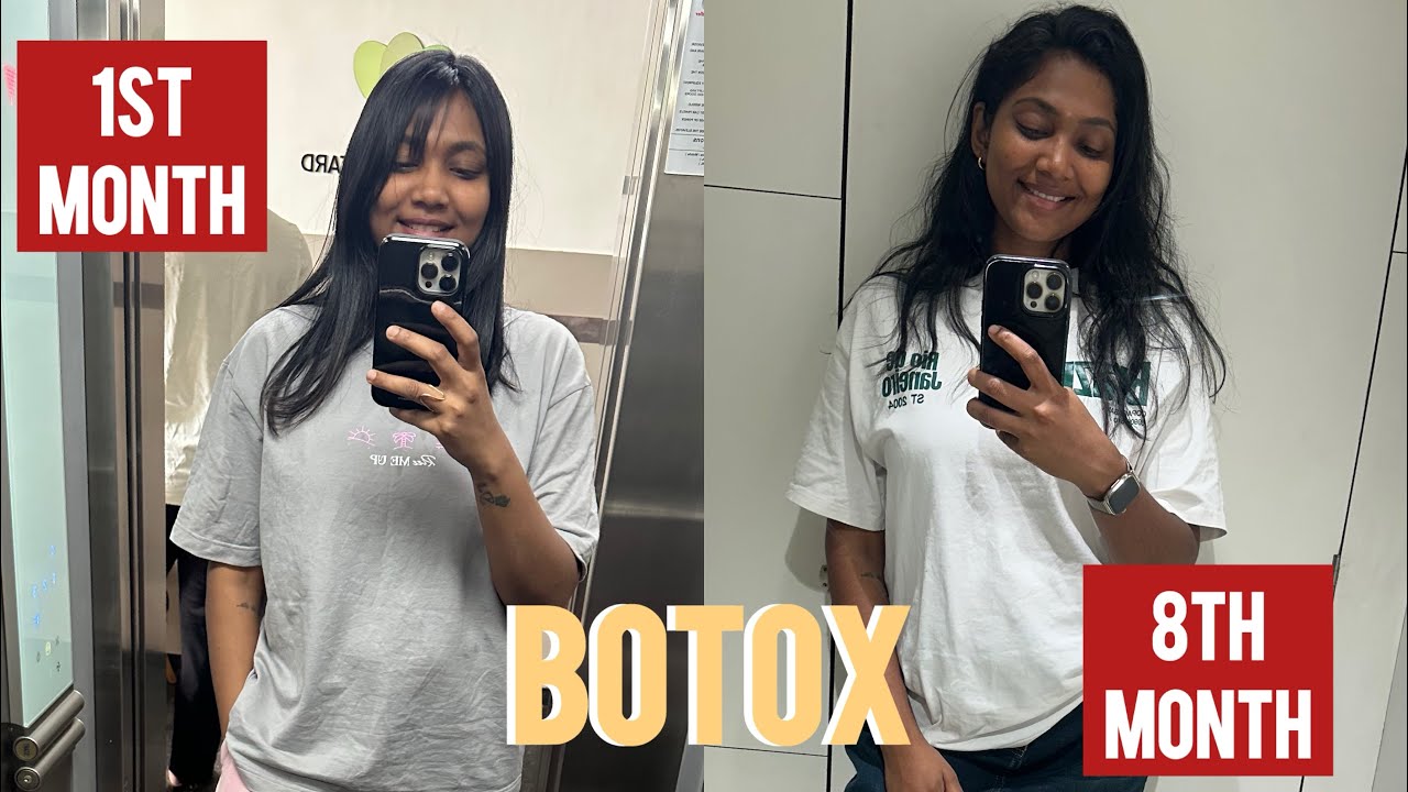 Hair Botox 8 Months Later | Honest IN DEPTH Review Tamil | Worth ah ? 