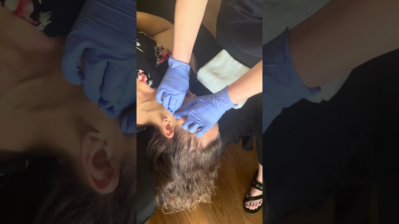 Intra Oral Massage Therapy - Masseter
