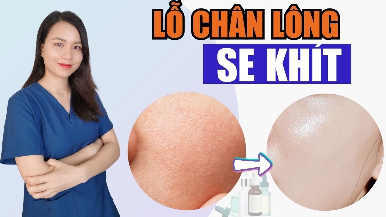 Cách thu nhỏ lỗ chân lông hiệu quả mà ít ai biết trong chăm sóc da | Nguyễn Mai Hương