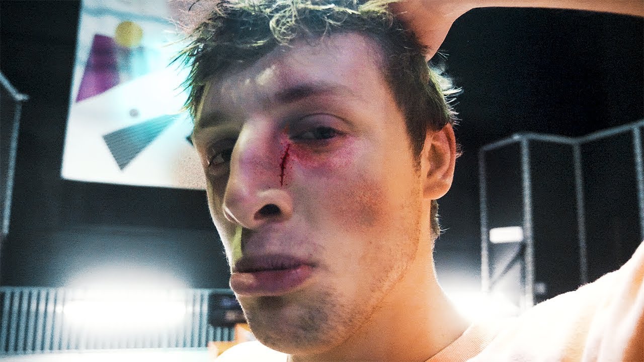 I SENT WROETOSHAW TO THE HOSPITAL...