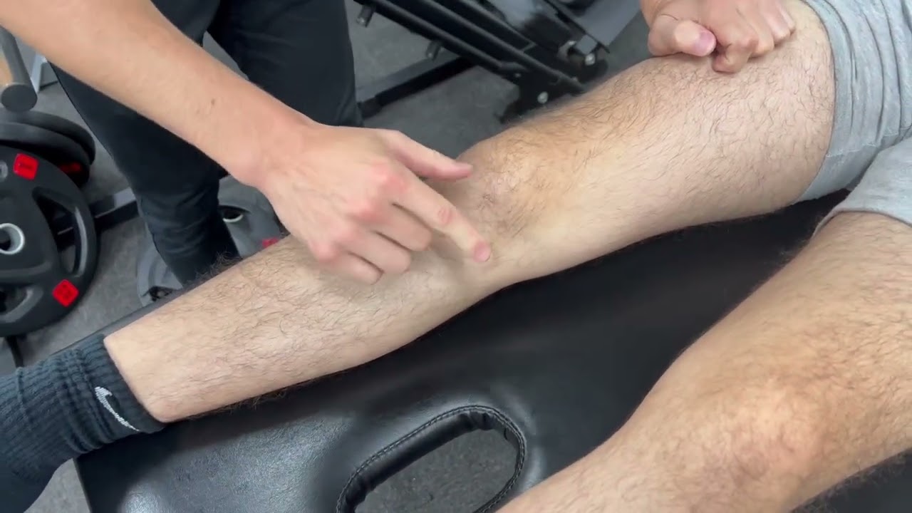 Brush/swipe Test for swelling in the knee