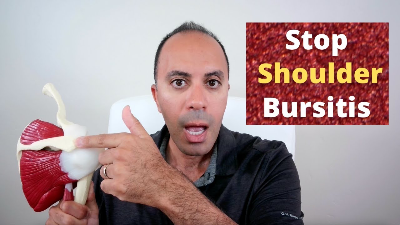 Stop Shoulder Bursitis Naturally: Symptoms, Causes, Healing Cycle & Treatment