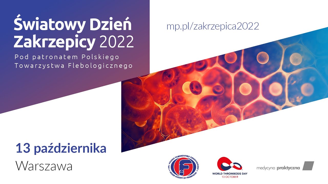 Zakrzepicy można uniknąć i można ją leczyć. Jeśli się o niej wie