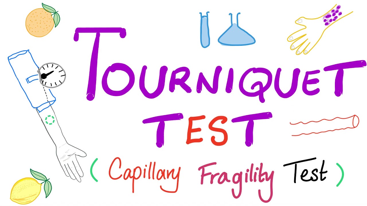 Tourniquet Test (Capillary Fragility Test)