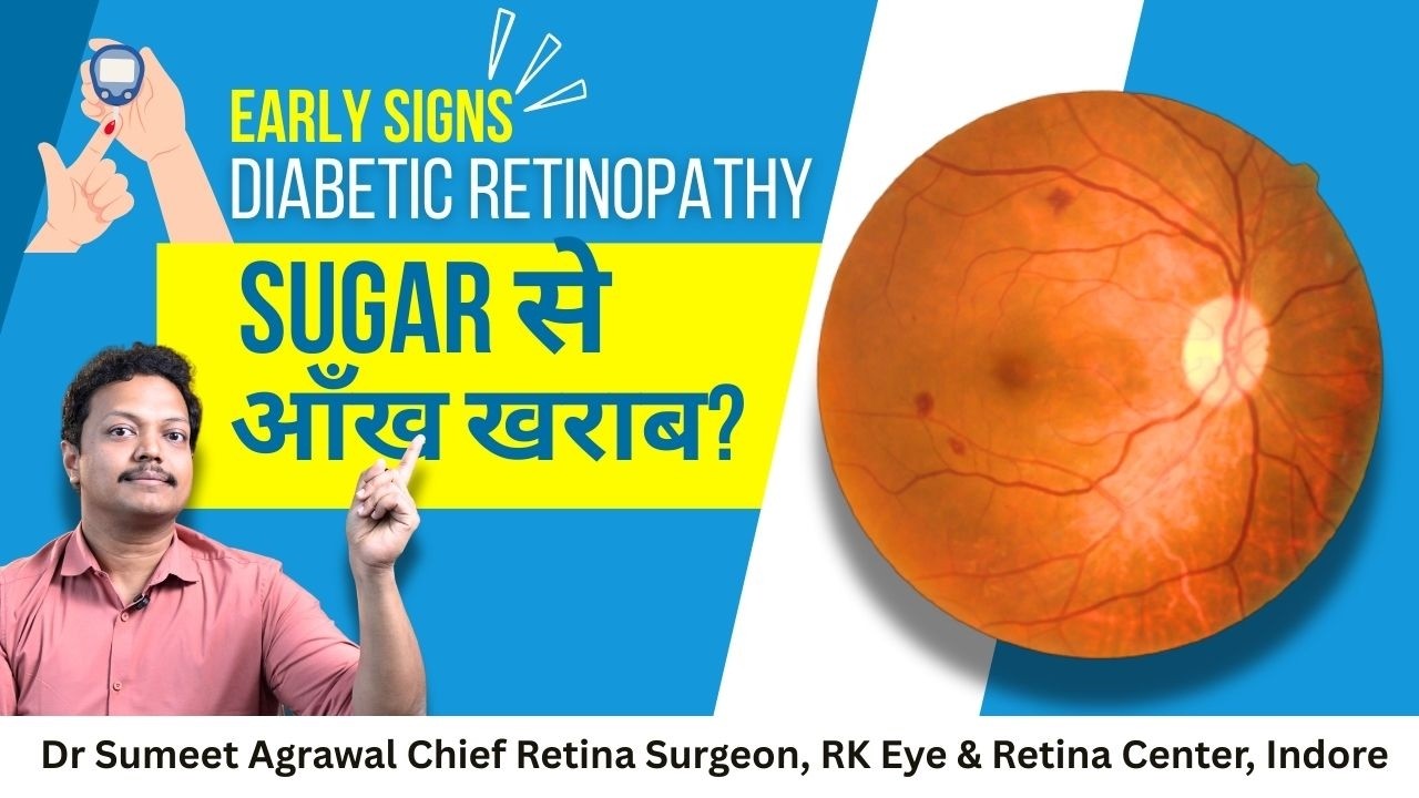 Diabetic Retinopathy क्या है? Diabetes से आंखों की रोशनी कैसे जाती है | Retina Damage Explained |