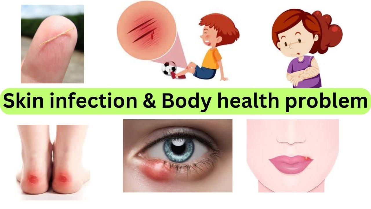 Body Health Problems | Illness Body Pain Vocabulary | English Vocabulary Verbs | English Verbs