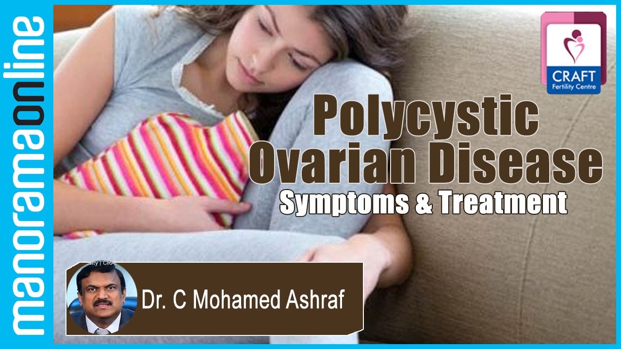 Polycystic Ovarian Disease | Symptoms & Treatment | Dr. C Mohamed Ashraf | CRAFT Fertility Centres