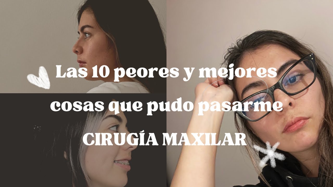 Las 10 peores y mejores cosas que pudo pasarme CIRUGÍA MAXILOFACIAL