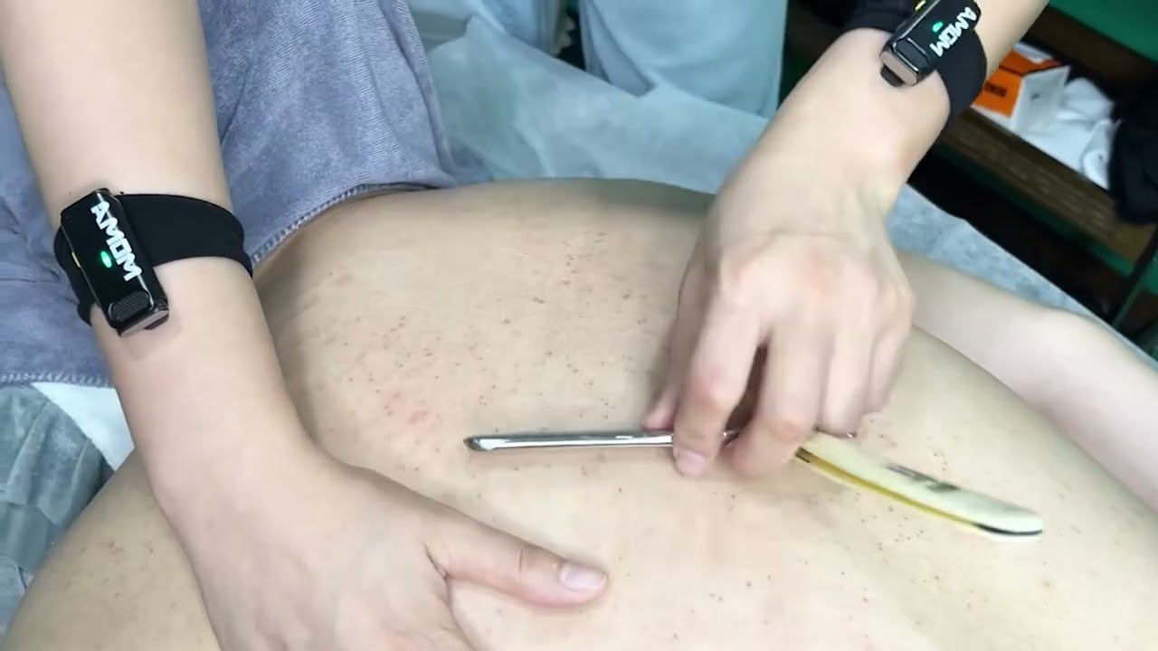 💈ASMR | Back Shave🪒Remove dead skin with an old-style straight razor