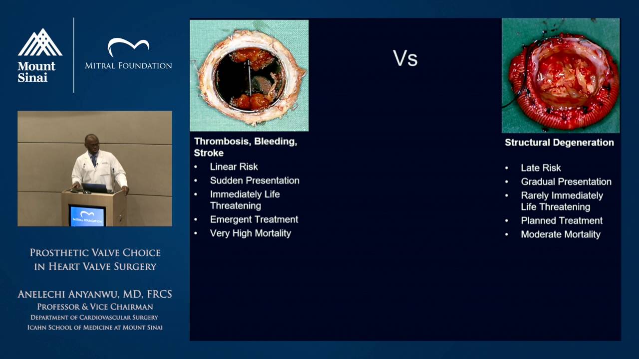 Prosthetic Valve Choice in Heart Valve Surgery