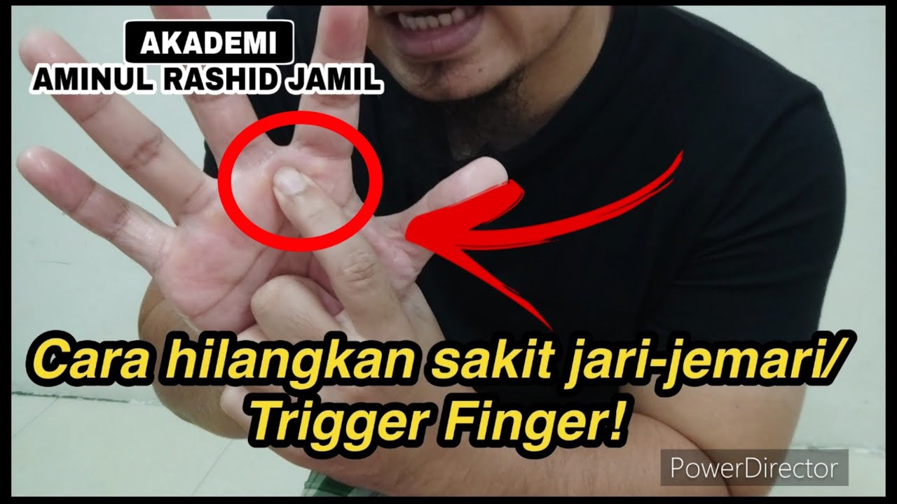 Cara mujarab urut Trigger Finger/ sakit jari-jemari/ jari sangkut-sangkut!- Biiznillah