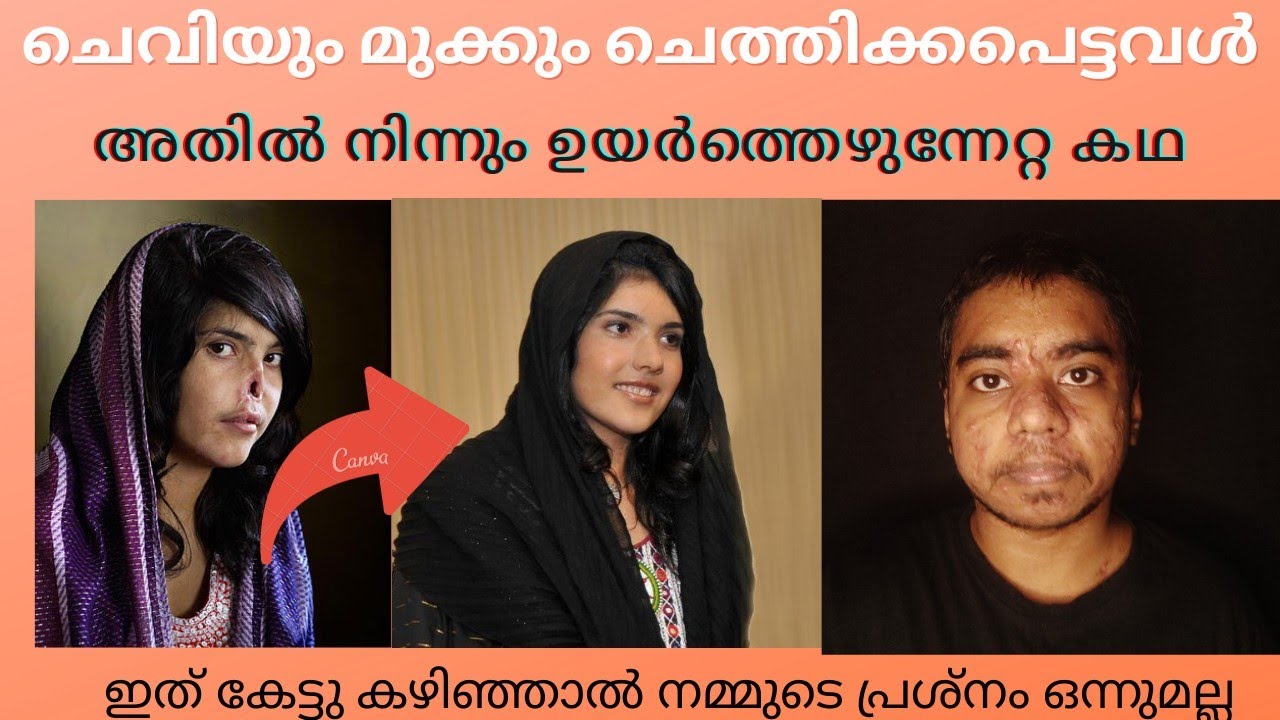 Bibi Aisha Inspirational Story | Explained | Malayalam | CrazyMallu